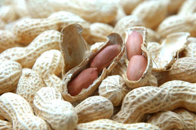 Peanut allergies can prove fatal