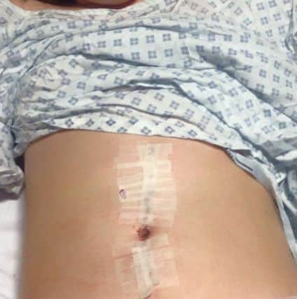 Penny Fawcett after her operation to give her a new navel.