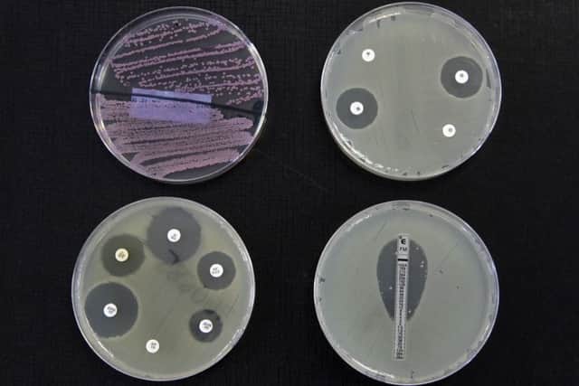 MRSA and superbugs are becoming more resistent to antibiotic drugs.