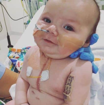 13-week-old Thomas Williams has undergone two major heart operations