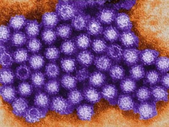 Norovirus has led to the closure of 45 wards in northwest England