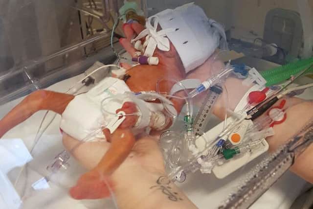 Baby Edgar in his incubator