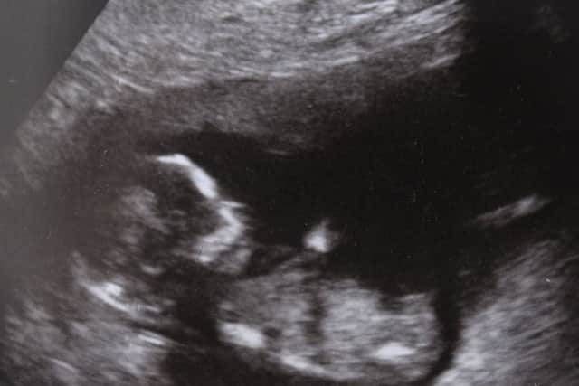 A scan of the couples baby
