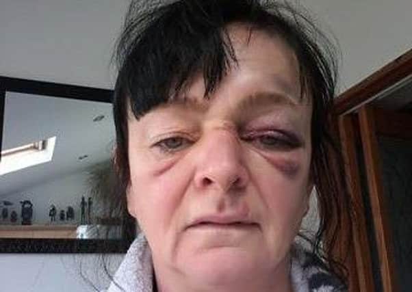 Marilyn Taylor was injured after being hit by a cyclist as she walked along Blackpool seafront