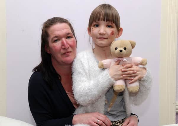 Blackpool mum Karen Wilkinson is looking to find the Good Samaritan family who came to her aid after her daughter fell of a bicycle. The family were having a Mothers Day bike ride when eight year old Abigail had the accident near the Norbreck Castle Hotel and they are keen to find and thank them for their assistance. Karen and Abigail with her teddy Smiley. Picture by Paul Heyes, Wednesday March 29, 2017.