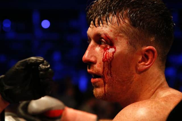 Cardle shows the scars of battle