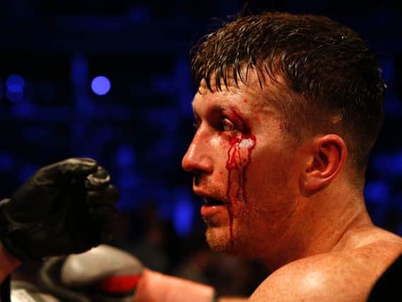 Cardle shows the scars of battle