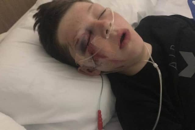 Jack Beckett, 12, suffered serious injuries on a ride at Cottam Hall Playing Fields in Poulton