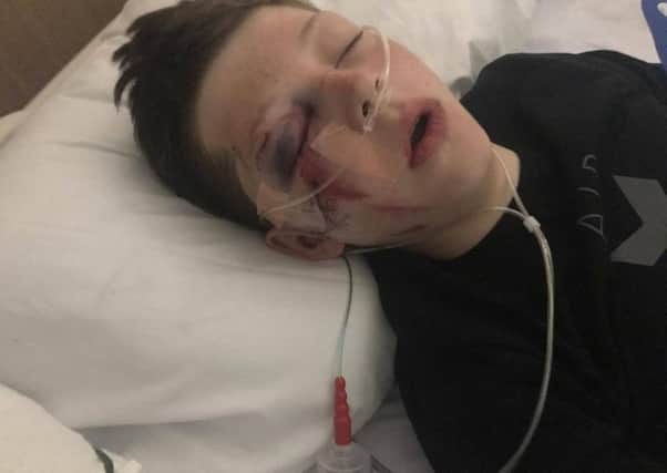 Jack Beckett suffered a fractured skull in the fairground fall