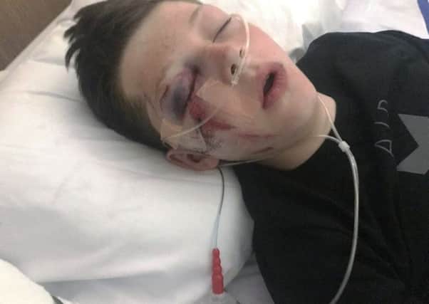 Jack Beckett-Chapman ended up in hospital after falluing from a fairground ride