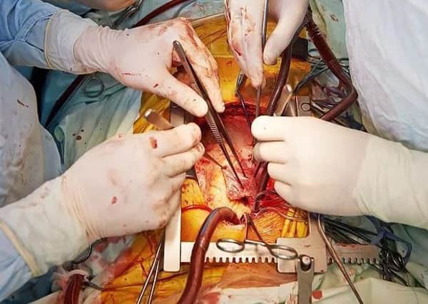 Children from schools run by the Fylde Coast Academy Trust (FCAT) will dissect pig organs at Aspire Academy next week (Picture: Operating Theatre Live)