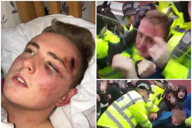 Rob Lanyon suffered facial injuries following the incident. Photos and video: Facebook/Jordan Bainbridge