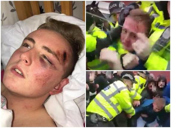Rob Lanyon suffered facial injuries following the incident. Photos and video: Facebook/Jordan Bainbridge