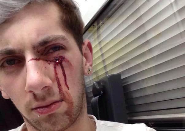 Joe Clarke was left battered and bloodied after one of the attackers stamped on his head.
